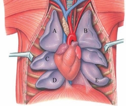 Identify the anterior lobe of the left lung in the figure shown.