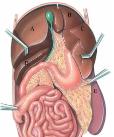 Identify the left medial lobe of the liver in the following figure.