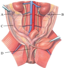 Identify the uterine tube in the following figure.  