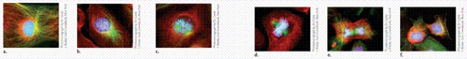 <strong> Photomicrograph by Dr. Conly L. Rieder, East Greenbush, New York Which stage of mitosis is depicted in photo A in the figure?</strong> A)interphase B)metaphase C)prophase D)anaphase