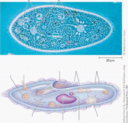 <strong> In the figure, what is the structure labelled as number 7?</strong> A)the gullet B)the mitochondrion C)the micronucleus D)the macronucleus