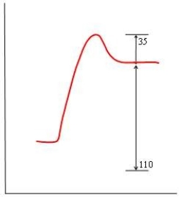<strong>In each of the following diagrams, the x-axis is the reaction coordinate and the y-axis is the potential energy. Which diagram corresponds to a reaction that has an activation energy of 35 kJ and an overall reaction energy of -110 kJ?</strong> A) B) C) D)