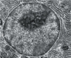 The very large organelle shown below has genetic control of a cell's activities. What is the name of this structure?