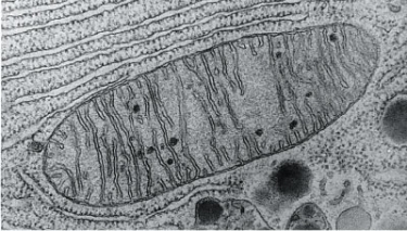 The organelle shown below is found in all cells but is most numerous in cells requiring a large amount of energy (e.g., liver cells). What is the name of this organelle?