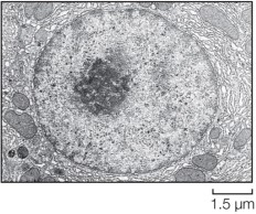<strong>Refer to the figure below showing tubular sacs that surround an organelle, synthesize lipids and steroids, and modify toxic molecules for removal. These sacs make up the</strong> A) mitochondrion. B) endoplasmic reticulum. C) nucleus. D) vacuole. E) cytoskeleton.