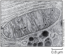 <strong>Refer to the figure below. The organelle shown is found in all cells but is most numerous in cells requiring a large amount of energy (e.g., liver cells).This organelle is called a(n)</strong> A) mitochondrion. B) endoplasmic reticulum. C) nucleus. D) vacuole. E) cytoskeleton.