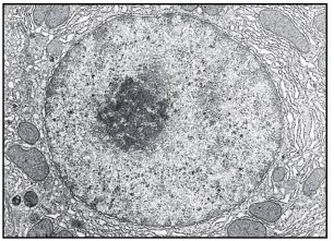 Refer to the figure below. The very large organelle shown in the figure, which contains the genetic material of a cell, is a _______.