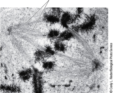 Refer to the figure showing a phase of mitosis. What phase is shown here?