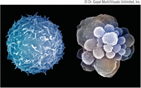 Refer to the figure showing two cells. The cell on the left is a healthy nondividing cell while the cell on the right is undergoing _______.
