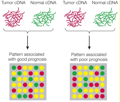 Refer to the figure showing the steps used in microarray analysis to detect differences in expression between tumor tissue and normal tissue.The spots in the bottom panel represent individual genes for patients who have good prognoses (left) as well as for patients who have poor ones (right).The colors of those spots represent levels of expression: red = high expression, yellow = intermediate expression, green = low expression. Look at the top leftmost spot.At this gene, patients with poor prognoses have _______ expression than patients with good prognoses.