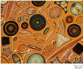<strong>Refer to the figure. What are the organisms shown in the figure?</strong> A) Diatoms B) Radiolarians C) Euglenids D) Foraminiferans E) Apicomplexans