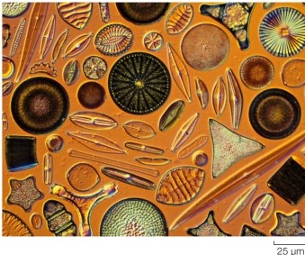<strong>Refer to the figure. The organisms shown most likely obtain nutrients by _______, and their movement most likely consists of _______.</strong> A) engulfing bacteria; free swimming using flagella B) photosynthesis; free swimming with cilia C) photosynthesis; floating in plankton D) engulfing bacteria; floating in plankton E) photosynthesis; free swimming using flagella