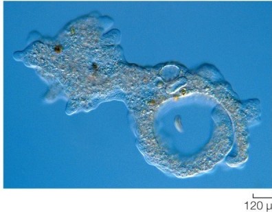 Refer to the figure. What type of organism is shown? Justify the reasoning behind your conclusion.
