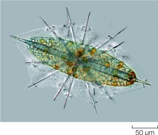 Refer to the figure. Why are thin, stiff pseudopods so useful to the radiolarian below?