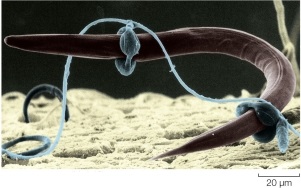 <strong>Refer to figure.   Which statement best describes the relationship between the nematode and the fungus shown?</strong> A) The fungus and nematode have a symbiotic relationship in which both benefit from each other. B) The fungus acts as a predator, trapping the nematode and invading it with hyphae to extract nutrients. C) The nematode is a parasite that takes nutrients from the fungus. D) The fungus acts as a parasite, invading the nematode and living within the host, causing only minimal harm. E) The nematode is a pathogen of fungi and consumes the hyphae as a source of carbon. <div style=padding-top: 35px> 