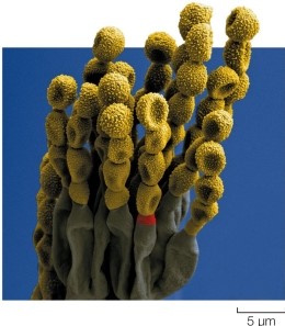 <strong>Refer to the figure.   The structures in the show in the figure are</strong> A) conidia, a means of asexual reproduction used by filamentous sac fungi. B) ascospores, a product of sexual reproduction used by club fungi. C) zygospores, which give rise to the male and female gametes of zygospore fungi. D) produced by the gametangia of chytrids after fertilization occurs. E) soredia, a form of asexual reproduction used by some lichens. <div style=padding-top: 35px> 