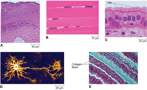 <strong>Refer to the figure. Which part of the figure shows the tissue most likely to be found lining ducts or tubules with a transport function?</strong> A) A B) B C) C D) D E) E