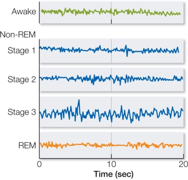 Refer to the figure below.The electroencephalogram (EEG) recordings for Awake and REM sleep are similar because