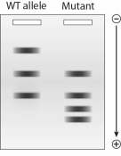 <strong>You set up an EcoRI restriction digest for a sample of genomic DNA from an individual with a hemoglobin mutation.To your surprise,you notice a different pattern of bands in the affected individualyou have identified a new SNP! What can you conclude from the pattern of bands from the gel below? </strong> A)The SNP resulted in the loss of an EcoRI site. B)The SNP resulted in the creation of a new EcoRI site. C)The SNP resulted in the loss of an exon. D)The SNP results in the creation of a new HindIII site. E)There was no change in the genomic DNA sequence.