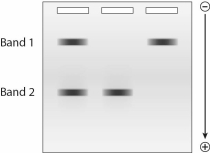Given the following gel,which DNA fragment has a lower molecular mass?