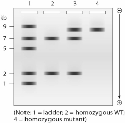 A SNP results in a loss of the XhoI site indicated,so you design a molecular probe that spans the lost XhoI site.Which lane represents the expected Southern blot of an individual who is a carrier (heterozygous)for the mutant allele?