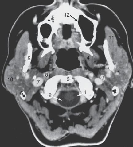 <strong>The internal jugular vein is labeled: </strong> A)6 B)7 C)8 D)9