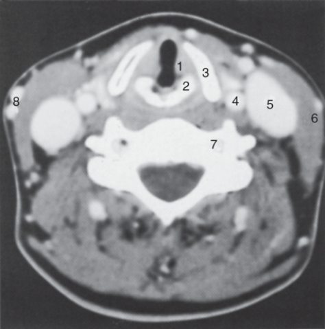 <strong>The common carotid artery is labeled: </strong> A)4 B)5 C)7 D)8
