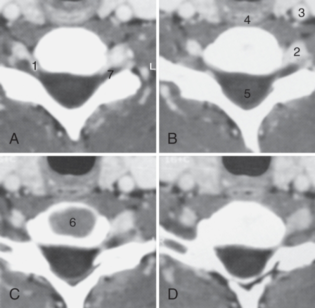 <strong>The intervertebral disk is labeled: </strong> A)4 B)5 C)6 D)7