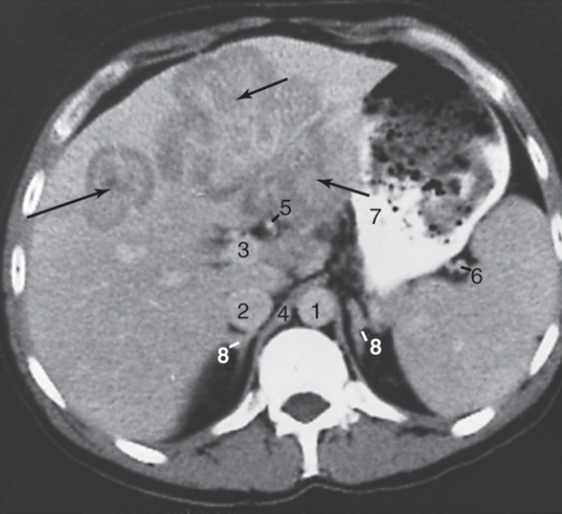 <strong>The aorta is labeled:  </strong> A)1 B)2 C)3 D)4 <div style=padding-top: 35px> 
