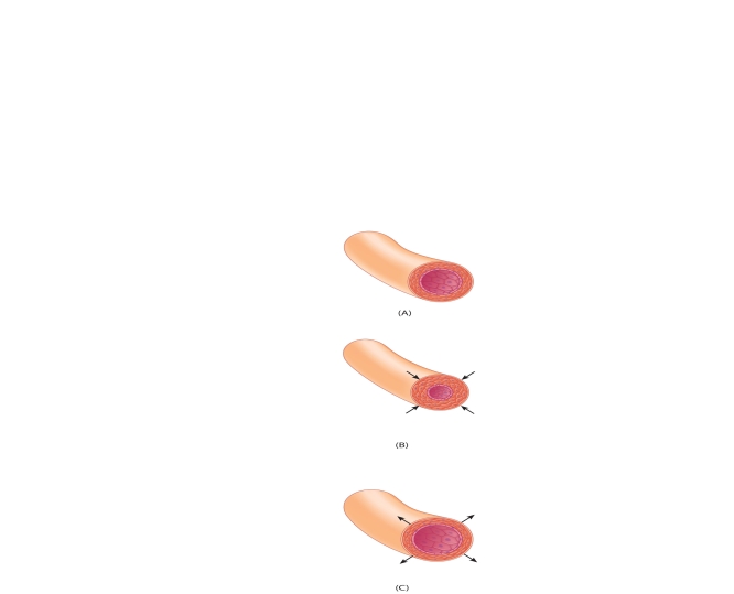 The following questions refer to the accompanying diagram of arteriole vasoconstriction and vasodilation. The diagram shows three state of arteriole tone. The top image labeled A, shows normal tone. The other two panels labeled B and C show different state of arteriole tone. Match the statements below with the correct arteriole using A, B, and C. -Caused by NE