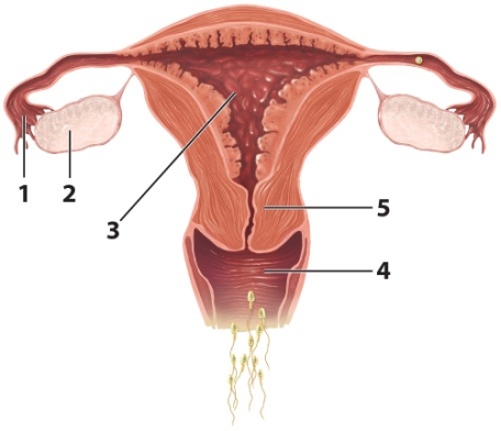 Use the diagram to answer Questions    -This is the oviduct.