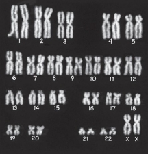 <strong>What is the gender of the person indicated in the photograph? </strong> A)Male B)Female C)Cannot be determined