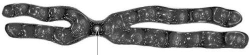 <strong>Name the part of the chromosome indicated by the arrow. </strong> A) Sister chromatid B) Gene C) Centromere D) Mitotic spindle