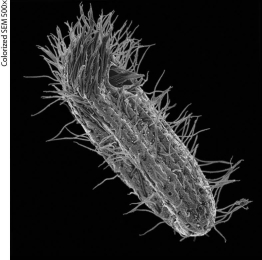 <strong>The figure below shows a Paramecium,a single-celled freshwater protist.The hairlike structures visible on the Paramecium allow it to move.These structures are ________. </strong> A)microfilaments B)intermediate filaments C)flagella D)cilia