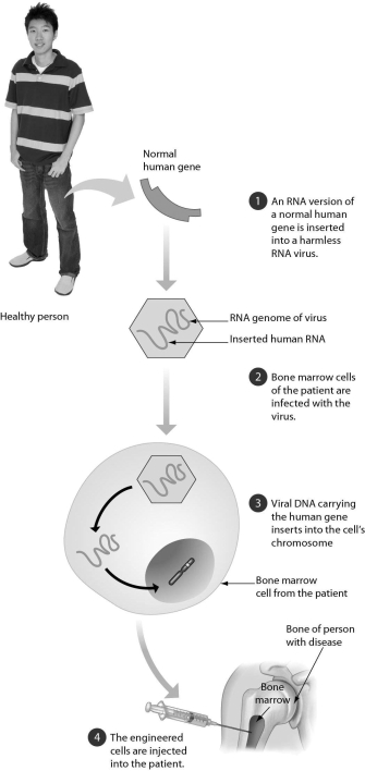 <strong>The diagram below summarizes ________. </strong> A)gene cloning B)how a human could be cloned C)human gene therapy D)how a vaccine is made