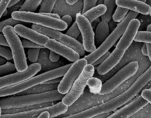 <strong>What kind of prokaryotes are these? </strong> A)bacilli B)spirochetes C)cocci D)ciliates