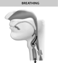 <strong>The figure below shows that ________.  </strong> A)peristalsis moves food down the esophagus B)air cannot get into the trachea when the epiglottis closes the trachea C)the trachea is open when you are not swallowing D)the trachea is closed when you are not swallowing <div style=padding-top: 35px> 