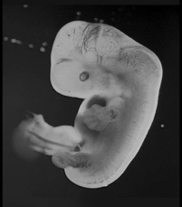 <strong>Examine the embryo in the following figure.The hands and feet of this embryo appear paddle-like,with no distinct toes or fingers.What process is needed to define each of the toes and fingers? </strong> A)programmed cell death B)neurulation C)gastrulation D)induction