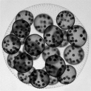 <strong>Volvox,the multicellular green alga shown here,has flagellated cells on its surface cells,but not on interior cells.Which of the following is the most likely explanation for the development of this condition? </strong> A) Interior cells attempt to grow flagella, but the lack of open space suppresses the effort. B) Interior cells discard the genetic instructions for flagella once their interior position is established. C) The commitment of resources for photosynthesis reduces the availability of protein and other biomolecules needed to produce flagella. D) Signals from surface cells or the absence of signals from the environment to the plasma membranes of the interior cells suppresses the growth of flagella.