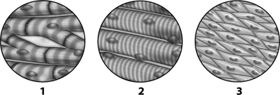 <strong>Analyze the tissue images below and select which statement is true.  </strong> A) Tissue 1 can be found lining the digestive tract. B) Tissue 1 is used to line the endocrine system. C) Tissue 2 is found attached to bones. D) Tissue 3 is used to conduct nerve impulses. <div style=padding-top: 35px> 