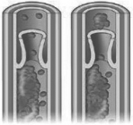 <strong>The figures shows a fragment of a clot separating and moving downstream in the venous system.When the clot encounters a vessel with a diameter smaller than itself it will become lodged and the flow of blood will be blocked.Where is this most likely to happen? </strong> A) in the aorta B) in the arteries or arterioles of the lung C) in the right atrium or right ventricle D) in the left atrium or left ventricle
