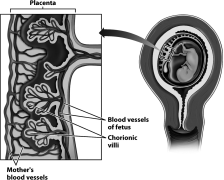 <strong>Examine this close-up of the placenta (on the left of the figure below). Why do the chorionic villi have the shape of a tree?</strong> A) The branches of the chorionic villi create a large amount of surface area for the exchange of nutrients and gases between maternal and fetal blood. B) The branches of the chorionic villi allow blood to flow back and forth more rapidly between the capillaries of the mother and her fetus. C) The branches of the chorionic villi create more locations where fetal capillaries can fuse directly with maternal capillaries. D) The branches of the chorionic villi create more surface area for the production of the amniotic fluid.