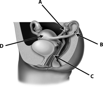 Which of the following structures are commonly manipulated for sterilization?