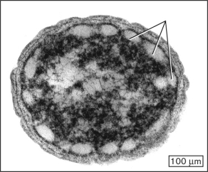 <strong>Which feature, indicated in the following figure, do Chlorobi share with Chloroflexi and Chloracidobacterium thermophilum? </strong> A) chlorosomes B) thylakoids C) halophily D) endospores E) hormogonia