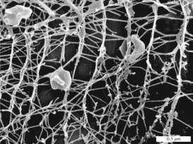 <strong>Pyrodictium species grow as networks interconnected by glycoprotein tubules called </strong> A) cannulae. B) pili. C) fimbriae. D) flagella. E) actin filaments.