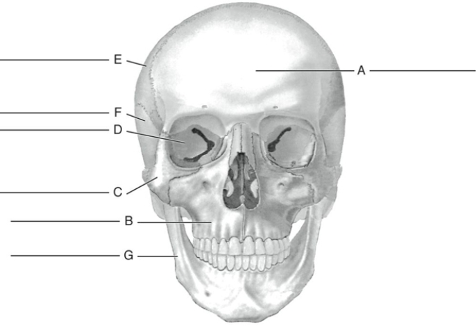 Fill in the correct labels for the following figure using the word bank below. a.Frontal b.Malar (zygomatic) c.Mandible d.Maxilla e.Parietal f.Sphenoid g.Temporal B _________