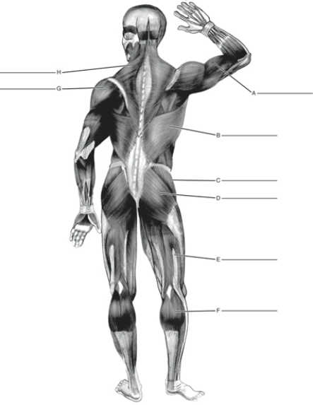 Fill in the correct labels for the following figure using the word bank below. a.Biceps brachii b.Biceps femoris c.Deltoid d.Gastrocnemius e.Gluteus maximus f.Gluteus medius g.Latissimus dorsi h.Trapezius H _________