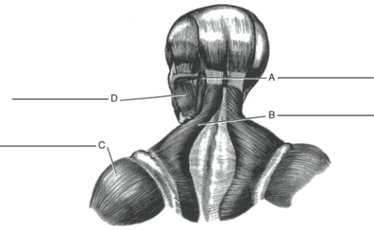 Fill in the correct labels for the following figure using the word bank below. a.Masseter b.Sternocleidomastoid c.Deltoid d.Trapezius C ___________
