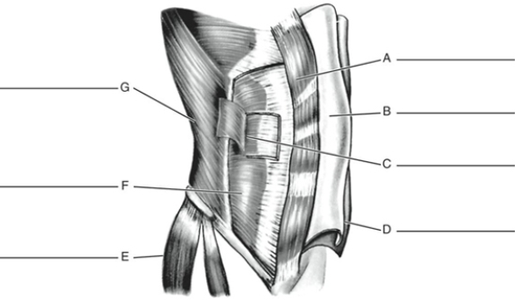 Fill in the correct labels for the following figure using the word bank below. a.Tensor fasciae latae b.External oblique c.Rectus abdominis d.Aponeurosis of internal oblique e.Transversus abdominis f.Internal oblique g.Aponeurosis of external oblique A ___________