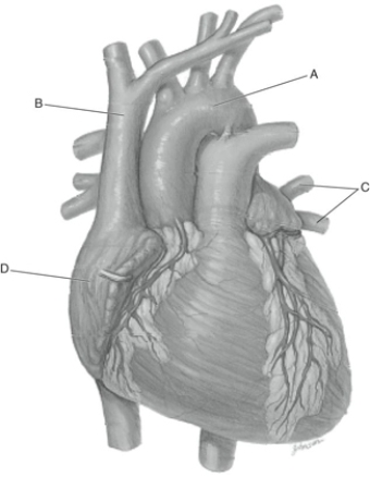 MATCHING Fill in the correct labels for the following figure using the word bank below. a.Aorta b.Pulmonary vein c.Right atrium d.Superior vena cava B ________